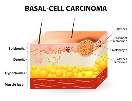 Skin structure diagram vectors material 02 structure skin diagram   