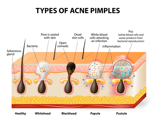 Skin structure diagram vectors material 05 structure skin diagram   